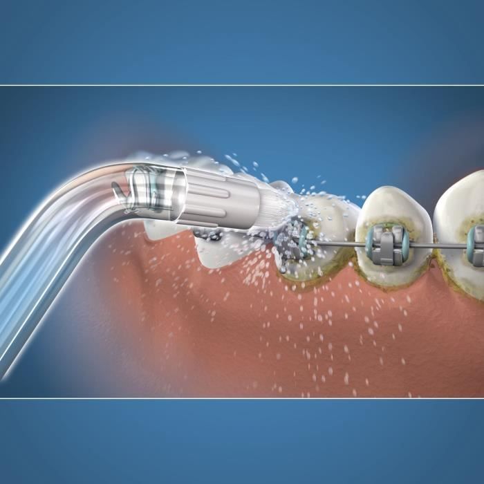 Embout Hydropulseur - WATERPIK - Orthodontique - …limine la plaque - SpÈcial appareils dentaires