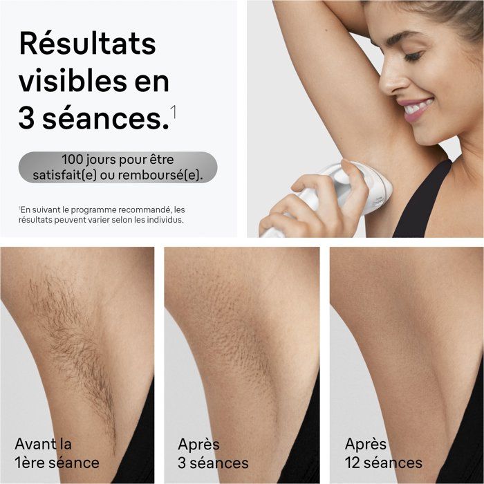 Épilateur a lumiere pulsée - BRAUN - IPL PL3020 - 300 000 flashs - Blanc
