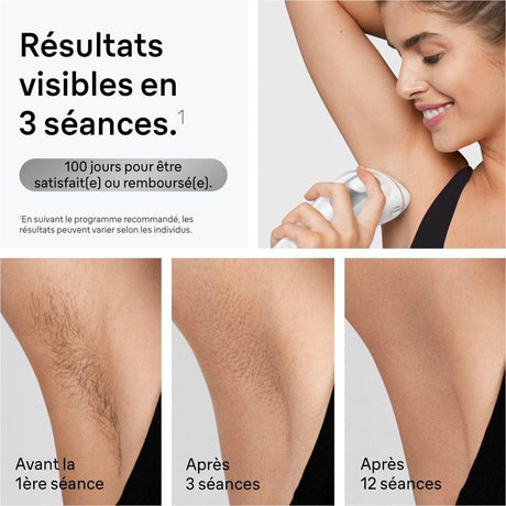 Épilateur a lumiere pulsée - BRAUN - IPL PL3020 - 300 000 flashs - Blanc
